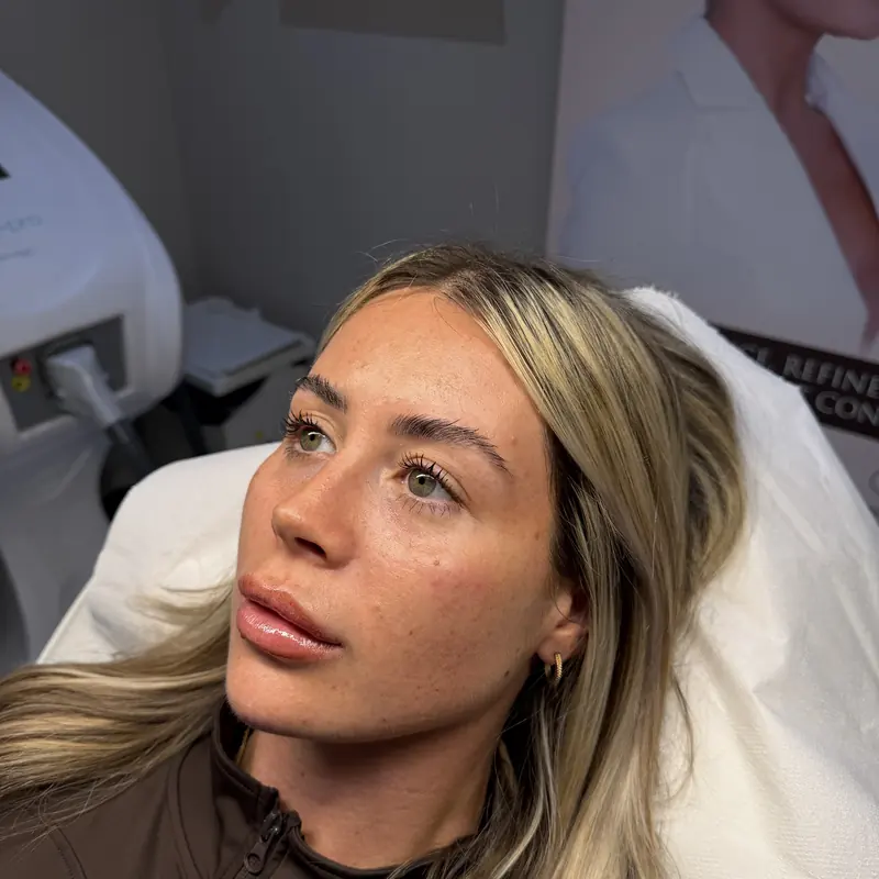 A client immediately after treatment at the Prestwich clinic