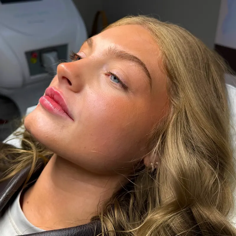 A client resting after lip filler treatment